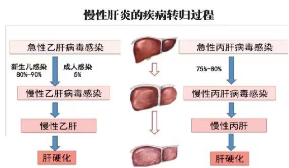 【健康科普】世界肝炎日——堅(jiān)持早預(yù)防，加強(qiáng)檢測(cè)發(fā)現(xiàn)，規(guī)范抗病毒治療